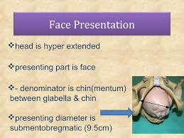 Image result for Shoulder Presentation