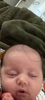 My babies head goes in right where I circled. Is this normal?