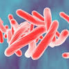 Ending tuberculosis is a race against time and drug resistance. Https Encrypted Tbn0 Gstatic Com Images Q Tbn And9gctrj2ws1xcplo2ngvje17gjtnpt2uebwicnddhht6i8ec7m0rhb Usqp Cau