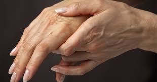Carpal Tunnel In Pregnancy Athletico