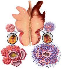 Микоплазменная пневмония свиней – причины, симптомы, лечение