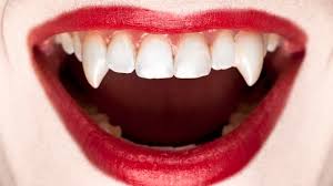 Get it as soon as fri, mar 26. Dentists Warn Against These Vampire Fangs Halloween Hacks On Tiktok Connect Fm Local News Radio Dubois Pa