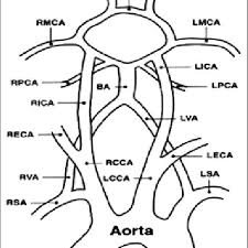 There are many possible anatomical configurations of the aortic arch and its branches. Vascular Anatomy Showing Common Carotid Artery Internal Carotid Download Scientific Diagram