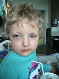 Dr. Soheil Meshinchi