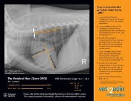 Image result for HEART Score