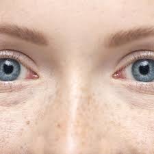 Melanoma is a kind of cancer that develops in cells that give your skin, eyes, and hair their color. Blue Eyes Anatomy Genetics Health Implications