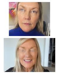 Bardot Aesthetics Ltd (@bardotaestheticsltd) • Instagram photos and videos