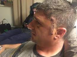 The Next Step Towards A Longer Life