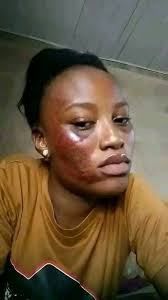 My husband is hitting me every day 😭 what can i do to stop him 😞.