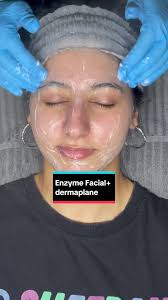 Enzyme facial with dermaplane Some steps I had to remove or only show part  of it to be able to make the video under one min @GlyMed Plus Skincare  #facial #facialtreatment #enzyme #enzymemask ...
