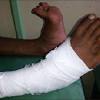 We have over 30 knowledgeable injury lawyers. Https Encrypted Tbn0 Gstatic Com Images Q Tbn And9gctgr Onvwkshlteg3xum0kl07fi1lty Bjvqplzbqctj3kwyply Usqp Cau