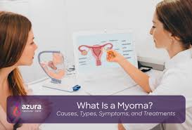 If you're not menopausal but have spotting between periods, that's a possible indication of uterine cancer. What Is A Myoma Causes Types Symptoms And Treatments