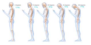 Découvrez une méthode naturelle à l'efficacité reconnue pour en soulager les douleurs. Douleur De Nuque Epaules Et Fatigue Oculaire Cts Christophe Carrio