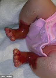 Image result for Tragedy as hungry dog kills 4-month-old baby