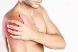 Impingement Syndrom Schulter Sporthomedic