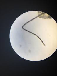 In those cases the hair will eventually push while you're examining your skin, bear in mind that tanning for men can cause spots that can be indicative of cancer. Leg Hair Follicle With Tiny Black Dots Throughout It Digitalmicroscope