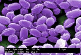 Image result for Anthrax