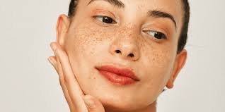 HOW YOUR WORKOUT CAN AFFECT YOUR SKIN: Idaho Skin Institute: Dermatology