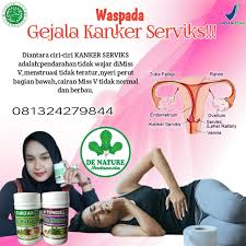 Klikdokter.com kanker serviks adalah pertumbuhan sel kanker yang terjadi pada leher rahim, berikut gejala, penyebab, dan cara pengobatan kanker artikel lainnya: Obat Kanker Herbal Serviks Kanker Serviks Kanker Mulut Rahim Cs Http Www Wasap My 6281324279844 Kanker Serviks Kanker Mulut Rahim Merupakan Kanker Yang Tumbuh Dan Menempel Pada Sel Sel Dinding Rahim Pada Awal Kemunculan Kanker Ini Biasanya Tidak