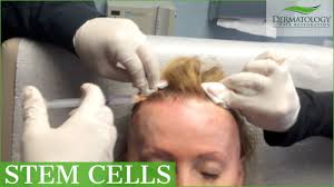 Located in los angeles, ca. Prp Stem Cells For Female Hair Loss Los Angeles Dr Ben Behnam Youtube