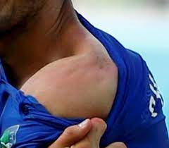 You can choose a typical. Kees Van Der Leun On Twitter Should Be Easy To Match With Suspect S Front Teeth Mt Peterleun Voetbalzonenl Chiellini S New Tattoo Suarez Http T Co Yxd0yd9k8h