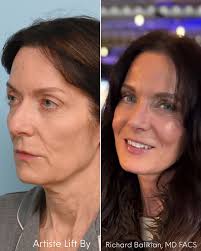 Balikian Plastic Surgery added...