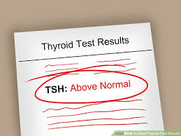 How To Read And Understand Thyroid Test Results Expert Guide