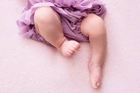 Scissor Legs Baby - Is it Cerebral Palsy?