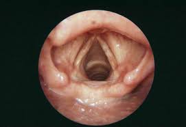 Prendes says, because they're difficult to recognize and categorize. Types Of Cancer Caused By Drinking Alcohol