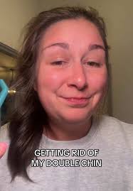 Chloe Kent Sunburn Double Chin