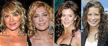 Cinesdebarrioseventies Kim Cattrall Plastic Surgery Before And After