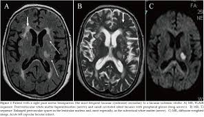 Pin On Neuro