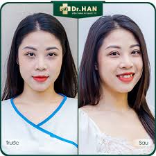 Trẻ hóa da công nghệ cao Hoa Kỳ