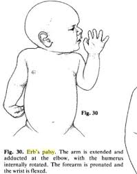 Pin On Neurology