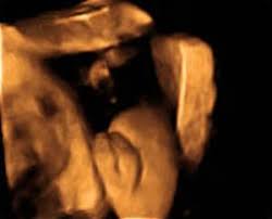 Ist er gefährlich fürs baby? 3d 4d Ultraschall Ultraschall Untersuchungen Diagnostik Frauenarzte Im Netz Ihr Portal Fur Frauengesundheit Und Frauenheilkunde