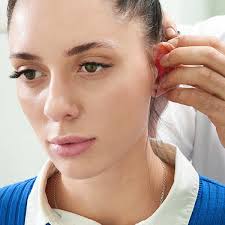 Elimine las orejas de soplillo con una Otoplastia en Panamá