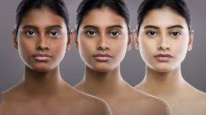 It's usually used to improve the appearance of blemishes such as birthmarks and dark patches (melasma). Whiter Skin In 14 Days Tracking The Illegal Sale Of Skin Whitening Creams In Canada Cbc News