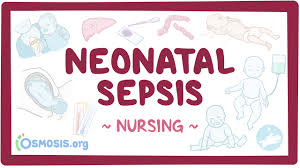 Image result for Neonatal Sepsis