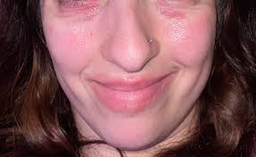 What helps with skin improvement?