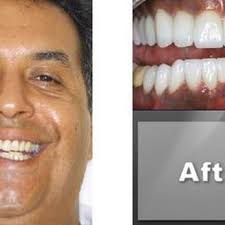 DUANE HEDRICK, D.D.S.