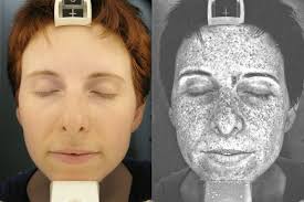 Model Turned Photographer Cara Phillips Show Us How Our Skin Under  Ultraviolet Light Looks Like And Reveal Sun Damage In Shocking Portraits