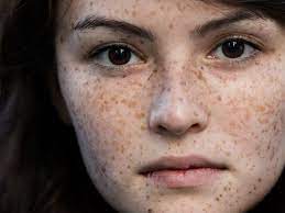 Layanan gratis google secara instan menerjemahkan kata, frasa, dan halaman web antara bahasa inggris dan lebih dari 100 bahasa lainnya. Cara Hilangkan Jeragat Dengan Cepat Bluebell Skincare