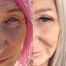 Apologies if you're getting fed up of me posting but I did promise to  update regularly