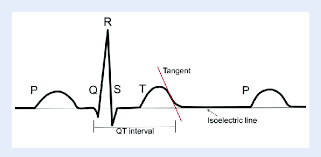 Image result for QT Interval