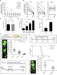 He is best known for his book series the witcher, which has been translated into 37 languages and sold over 15 million copies. Astrocytic Trans Differentiation Completes A Multicellular Paracrine Feedback Loop Required For Medulloblastoma Tumor Growth Sciencedirect