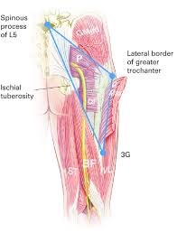 The Gluteal Triangle G Max Gluteus Maximus G Med Gluteus