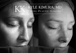 Kyle Kimura, MD
