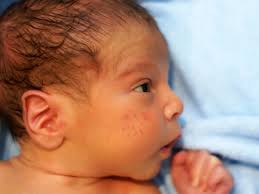 Baby eczema can be very worrying for new parents. Baby Acne Faq Symptoms Treatment And Different Types