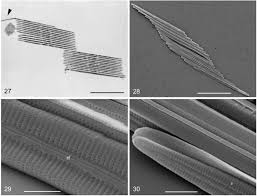 Image result for Entada bacillaris