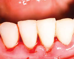 Children S Dental Concerns And Injuries